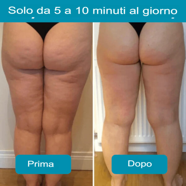 Cellulite Massager - immagine 4